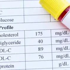 Wynik lipidogramu: cholesterol 175, trójglicerydy 40, HDL 89, LDL 76 mg/dL. To badanie ocenia poziom tłuszczów we krwi.