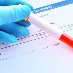 Ręka w niebieskiej rękawiczce trzyma probówkę z krwią nad raportem laboratoryjnym, gdzie widnieje wynik badania **ferratyna** 62.3 ng/mL.
