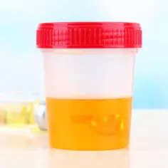 Pojemnik z czerwonym wieczkiem zawiera żółty płyn, przypominający próbkę moczu. W tle widać inne naczynia laboratoryjne.