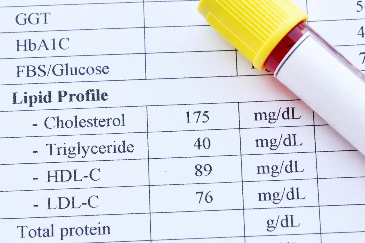 Wynik lipidogramu: cholesterol 175, trójglicerydy 40, HDL 89, LDL 76 mg/dL. To badanie ocenia poziom tłuszczów we krwi.